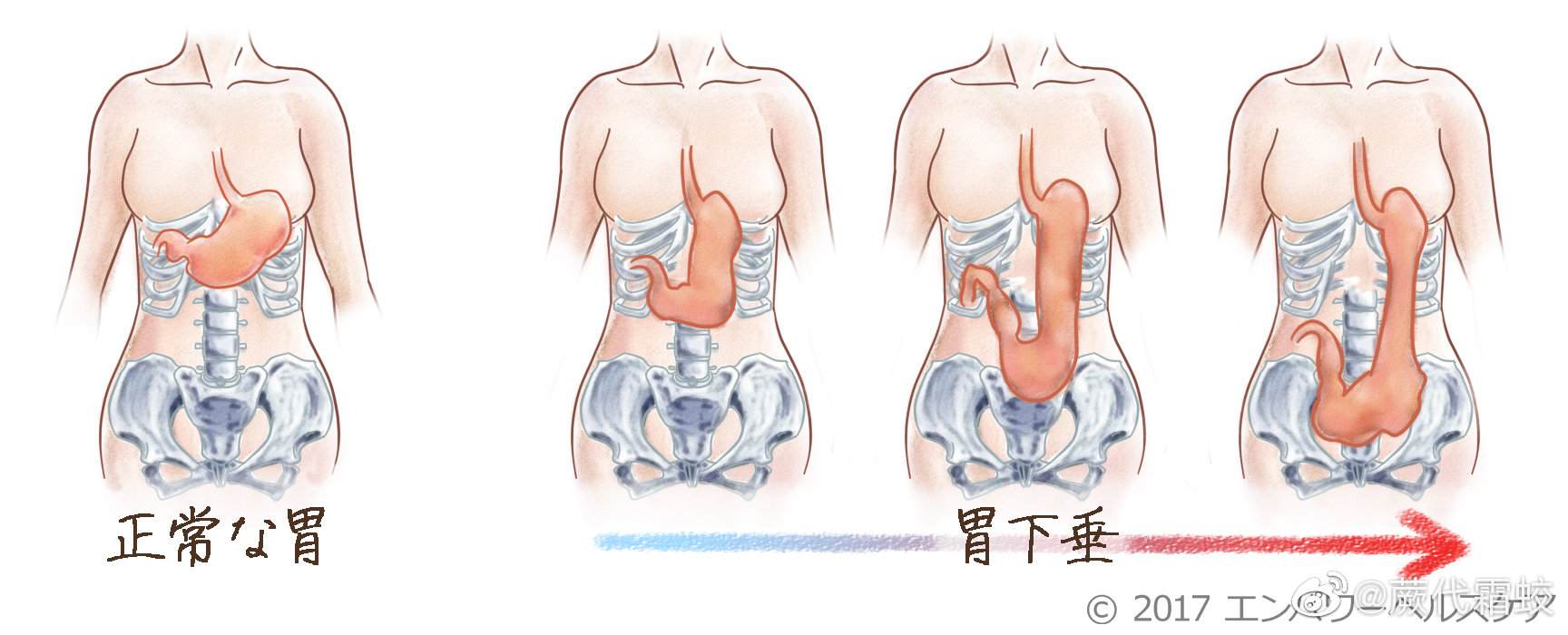 产后胃下垂的症状图片图片