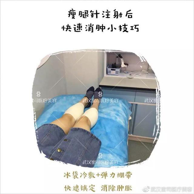 露腿的季节,注射瘦腿针,能瘦多少?|武汉蜜司庞力主任科普