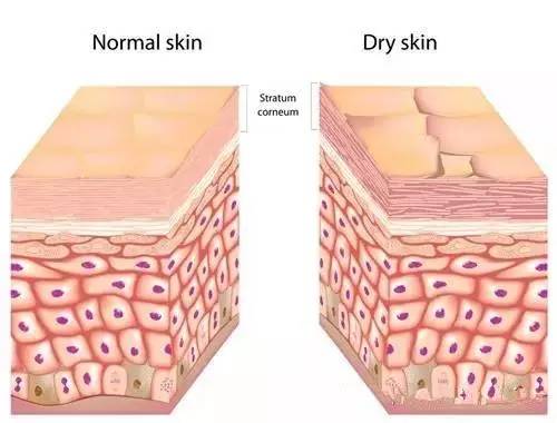 答:中性皮肤质感光滑,柔嫩,具有健康的光彩,皮肤组织幼细,没有粗大的