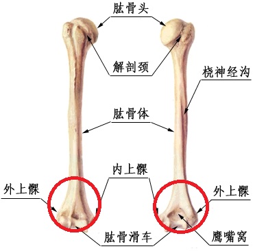 肘关节上方骨折:即肱(gōng)骨髁(kē)上骨折,指肘关节上方约2cm处的