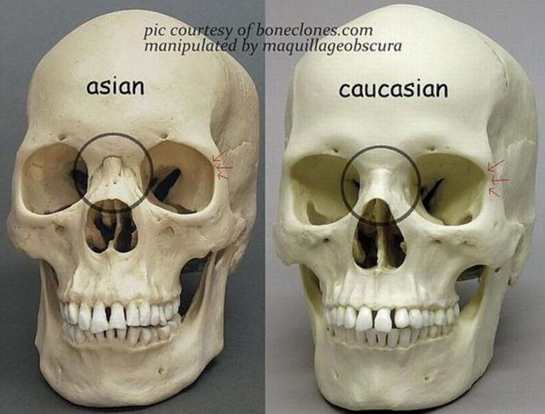 东方人和西方人基因和骨性上的差异 导致了双眼皮根本上不同