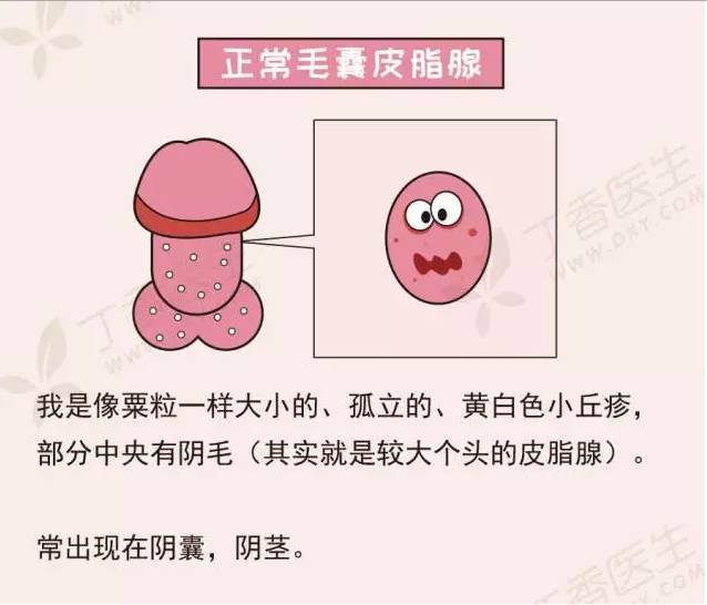 你尝试把丁丁部位的皮肤绷紧,就能更清楚地看到这些撒了欢儿的皮脂腺