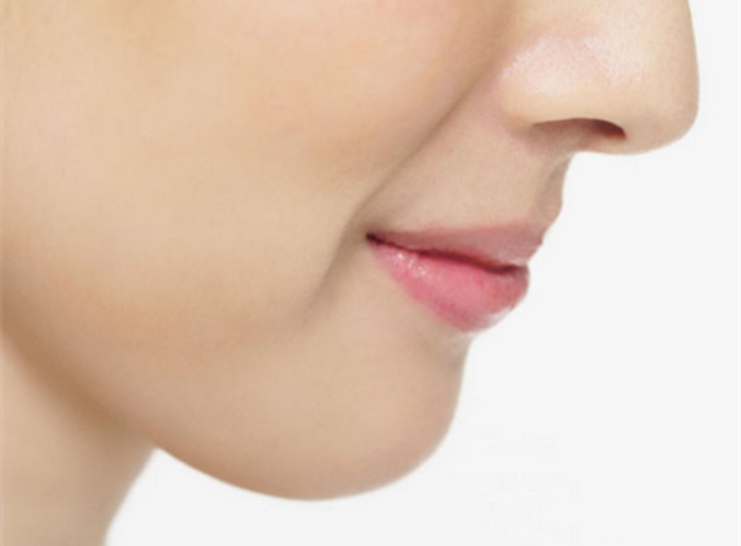 鼻唇沟的分析及美化 - 哔哩哔哩