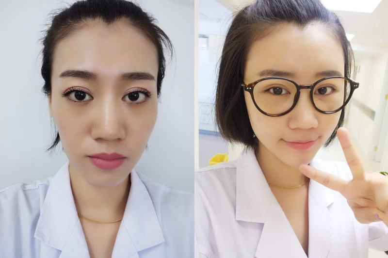 面部年轻化三部曲