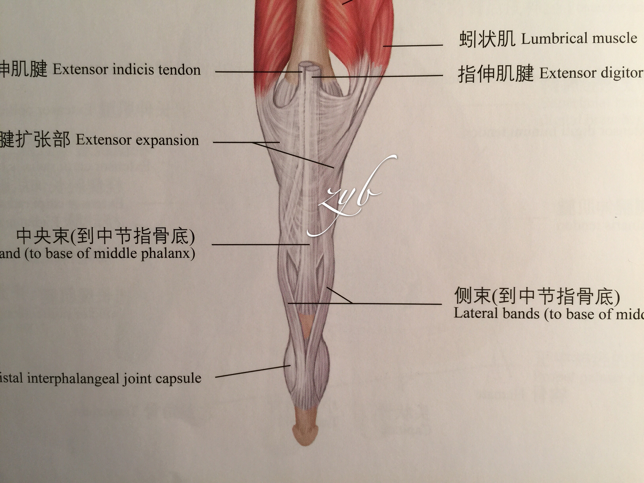 整形显微001 在手指头上钉纽扣 骨性锤状指的经典手术治疗 郑元波副主任医师 爱问医生