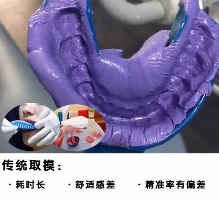 种牙取模全过程