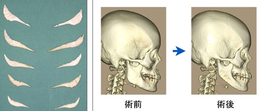 颧小肌,_大山谷图库