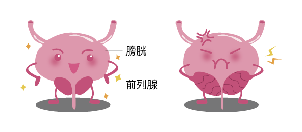 男女注意！千万别憋尿  外科防治室