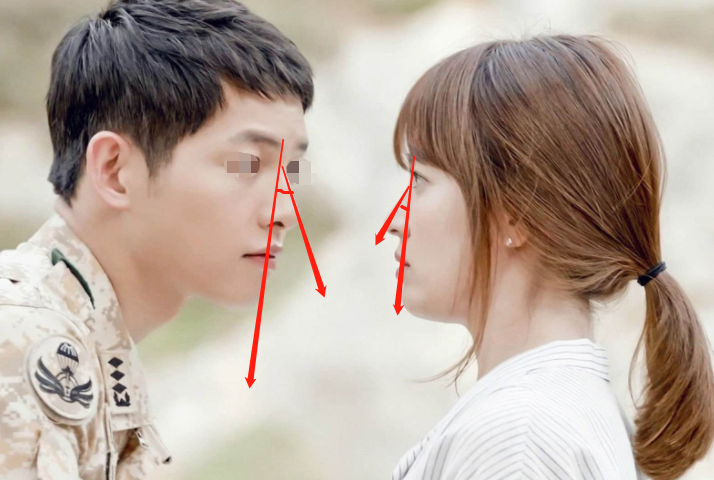 真正好看的鼻面角是怎样的?