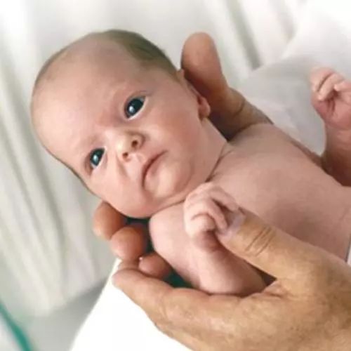 歪头就是斜颈吗？如何判断宝宝是否有斜颈？