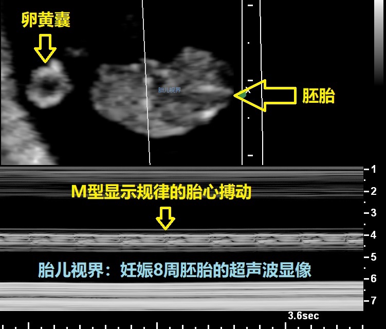在美国第一次的超声波检查常常就在妇产科医生的诊所办公室内