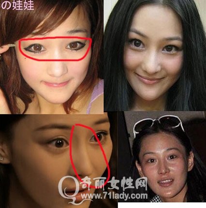 疑似张馨予小号曝出众多秘密张馨予大方承认整容多图