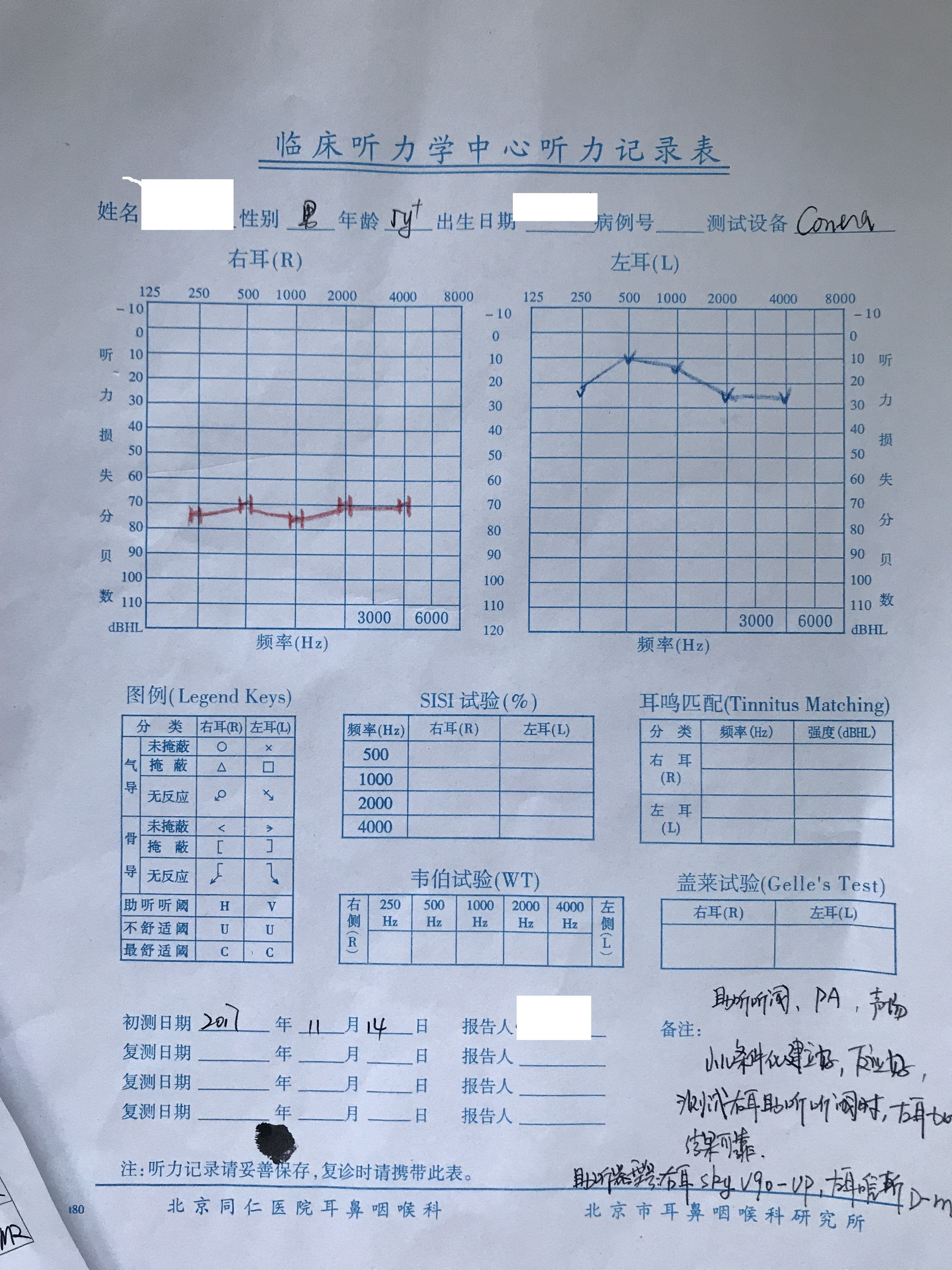 没有达到理想状态,但是全频都有放大效果,使得听力师和家长增强了信心