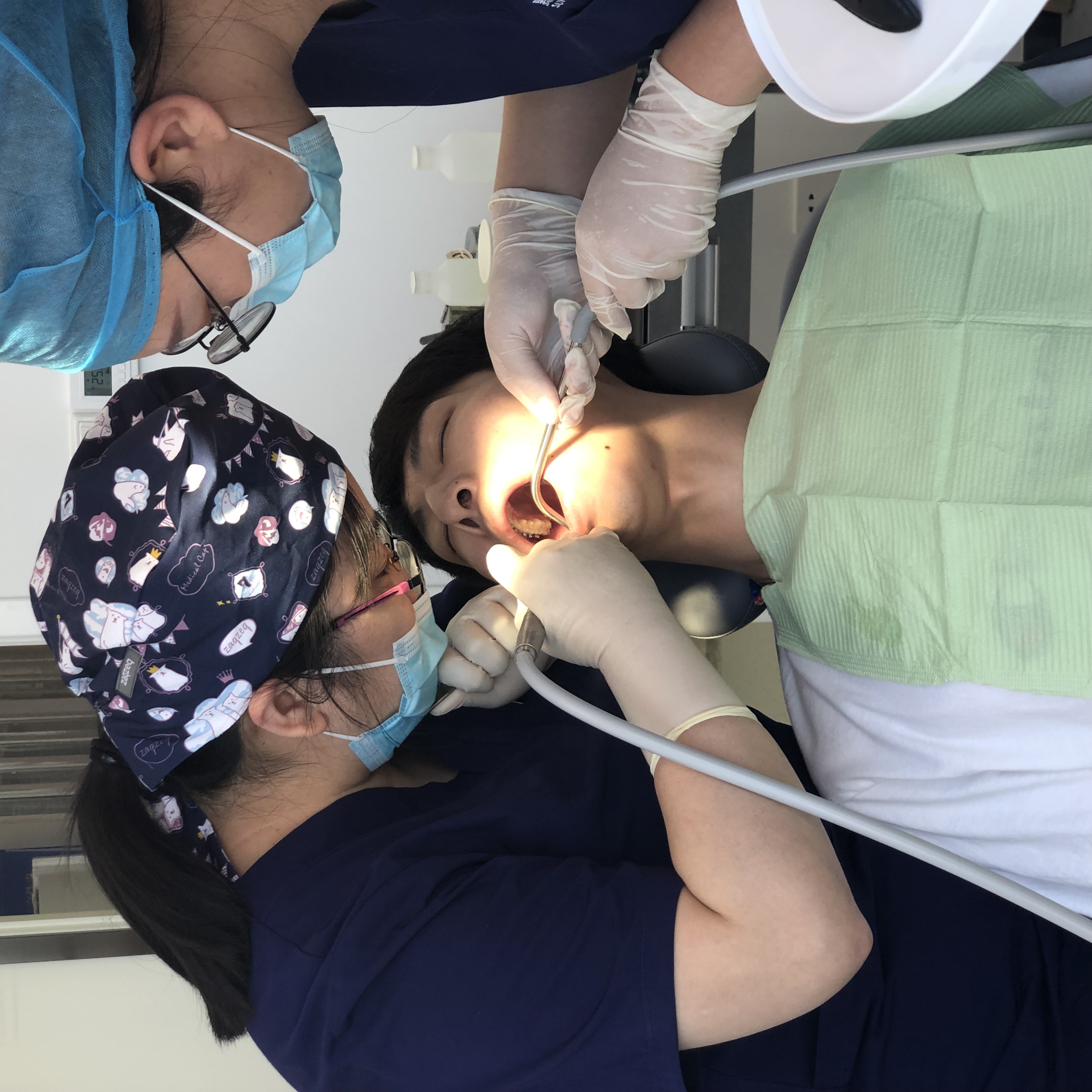 水平阻生智齿的拔除过程