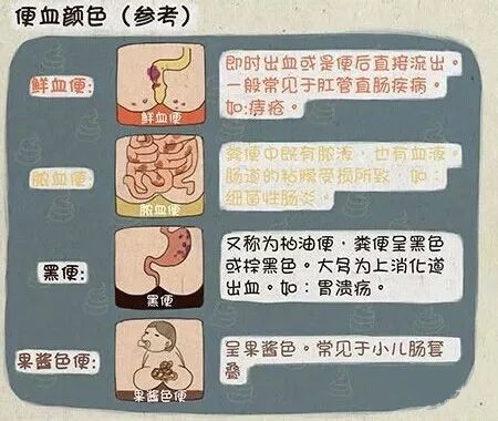 腸癌才是真正的偽裝者總讓你以為是痔瘡