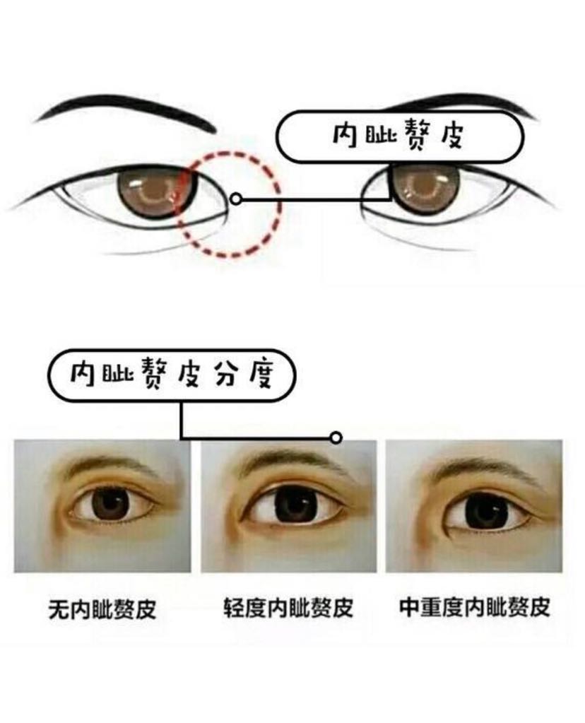 开眼角-张洁-爱问医生