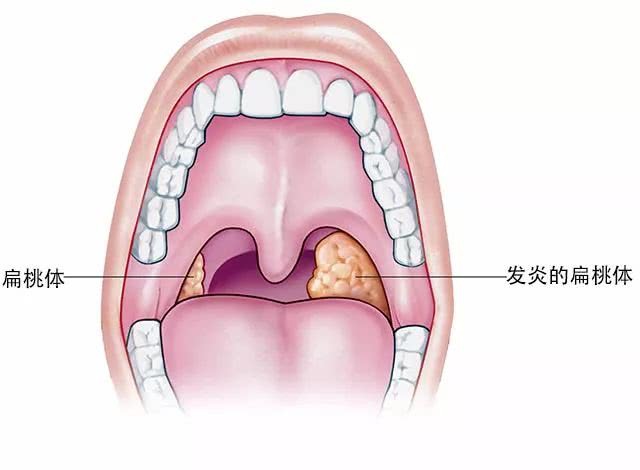 嗓子眼喉咙图片图片