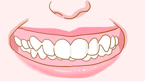 牙齿深覆合不进行矫正会有什么危害呢?