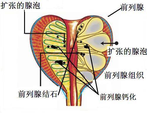 前列腺32根腺管图图片