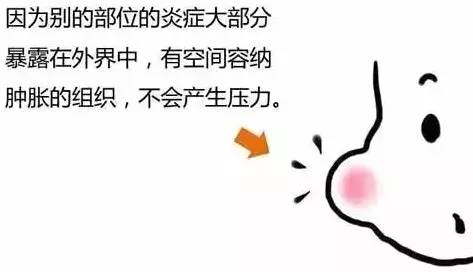 牙疼不是病疼起来可要人命啊