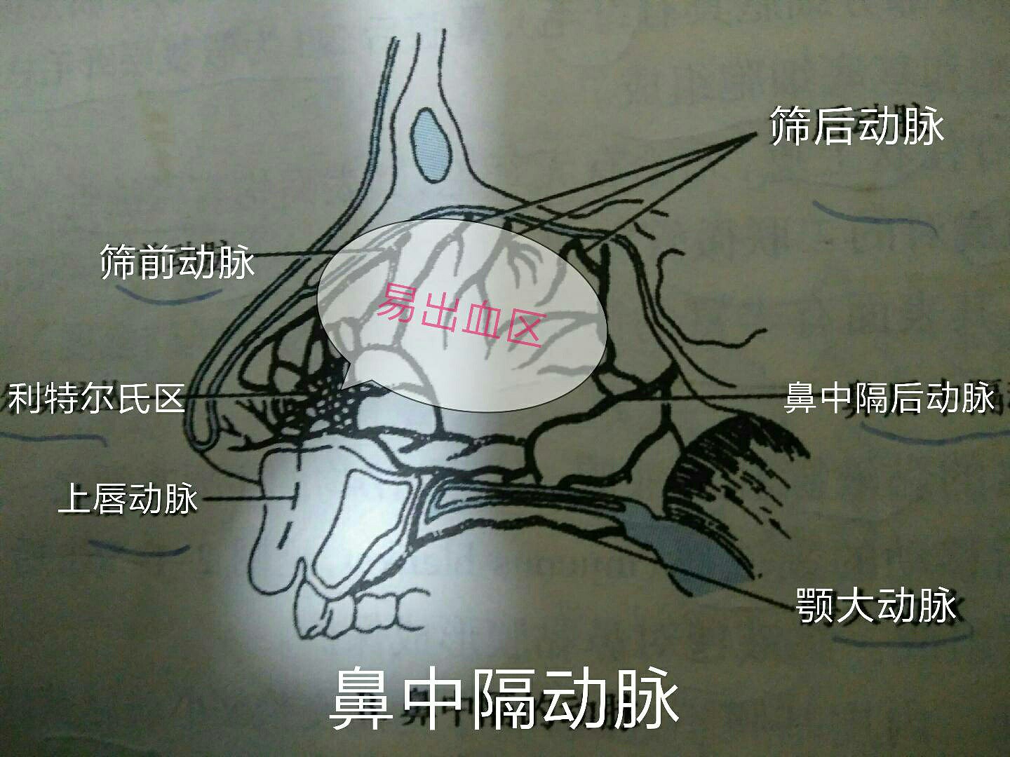 频繁的鼻出血怎么办啊?-高宏飞副主任医师-爱问医生
