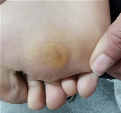 爱问健康_潘廷猛_副主任医师_爱问健康