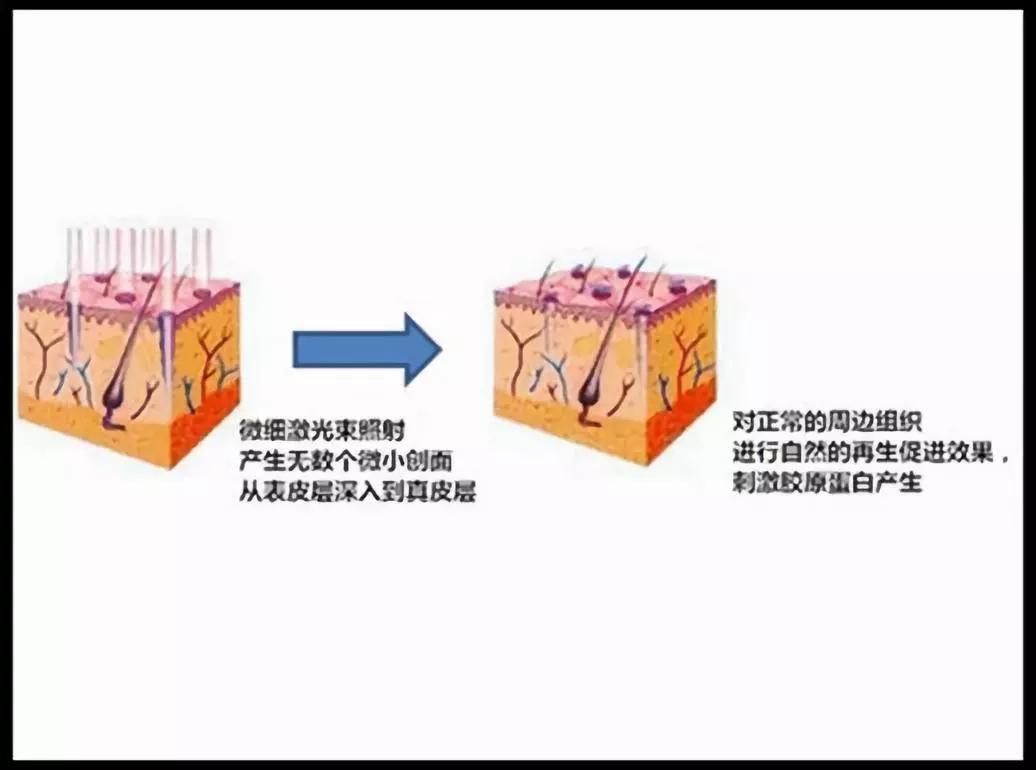 被女明星頻頻