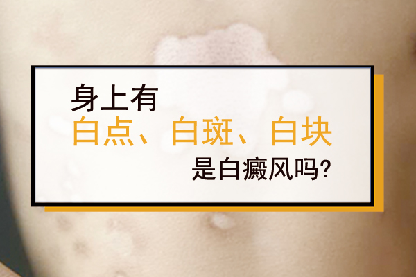 的白斑——边界清楚白癜风实际上是一种发生在后天环境中的皮肤病