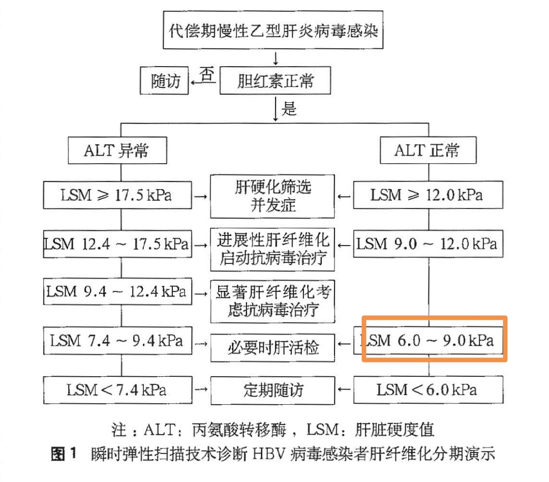 肝弹性怎么看?看完这两张图清晰了