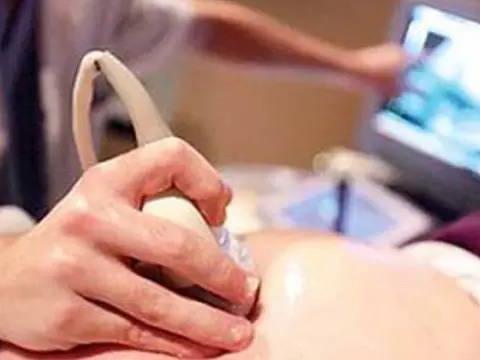 需要做多少次b超要依据具体情况而定,如果没有必要,不要频繁做b超检查