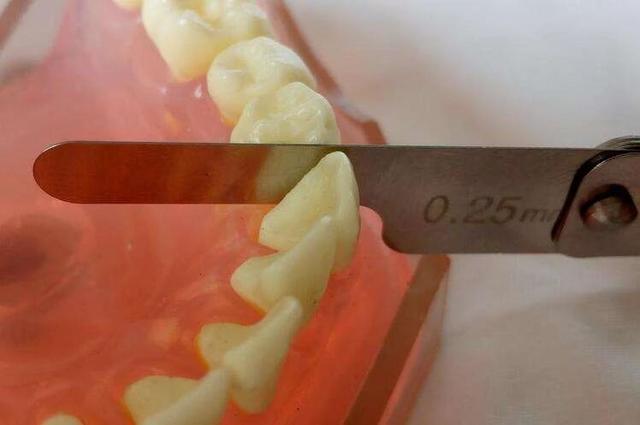 在牙齿矫正中,"邻面去釉"安全吗?