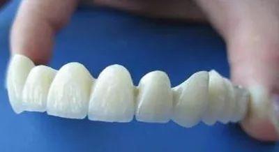 二氧化锆的牙冠好用吗?有什么优点?