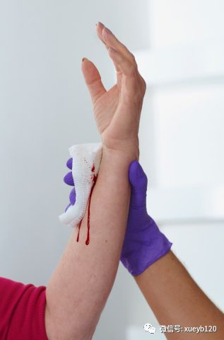 血友病患者出血了,到底要提升多少因子?