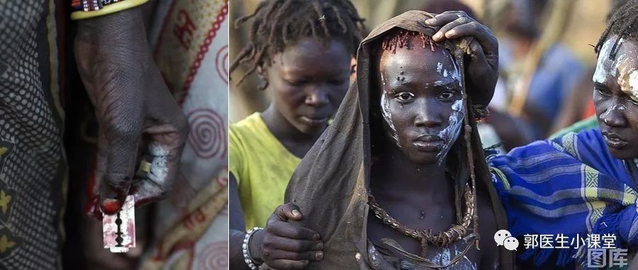 非洲女人毛多高潮图片