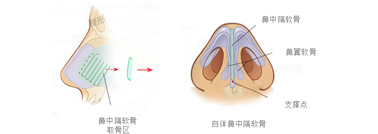 中国美容整形外科杂志刊发的一篇名为《国人鼻中隔软骨的解剖学研究》