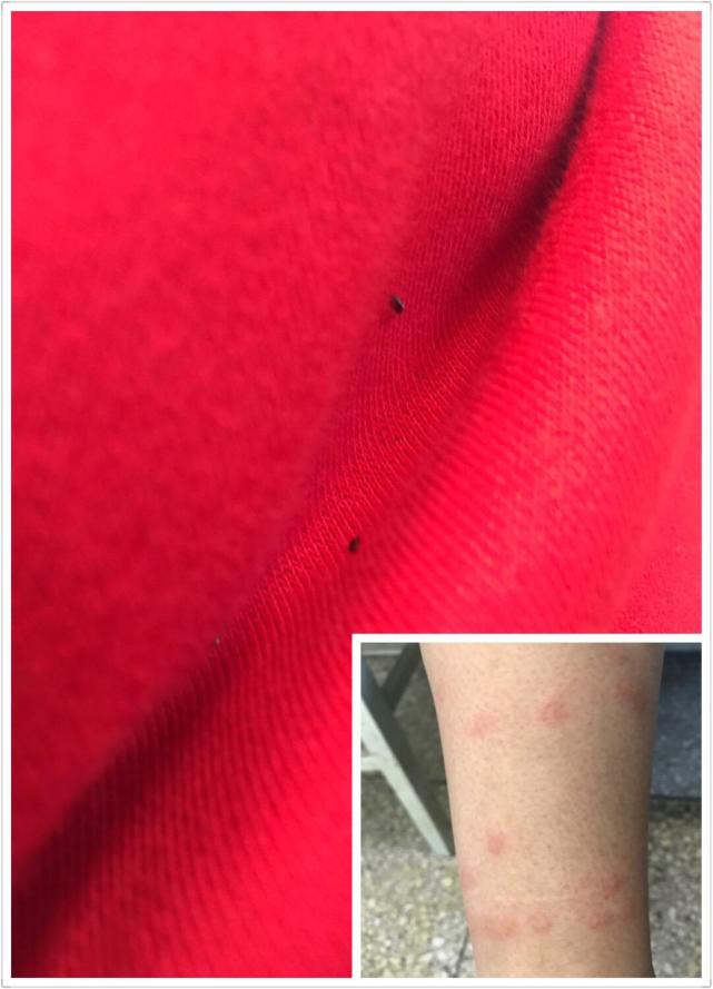 关于被跳蚤叮咬的三个小故事