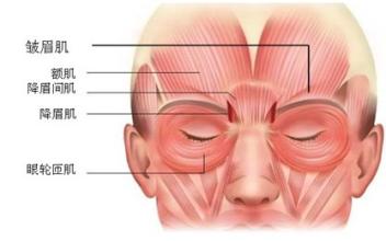 ③眉间纹:它是由降眉肌,皱眉肌,额肌,眼轮匝肌等多个肌肉收缩引起的