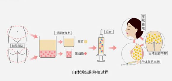 注射除皺原理是利用肉毒素抑制周圍運動神經末梢突觸前膜乙酰膽鹼釋放