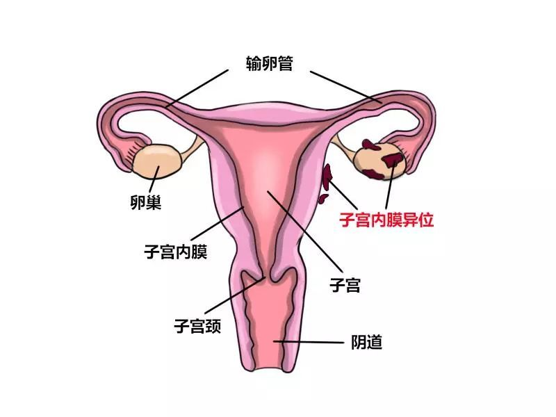 子宫和宫腔的位置图图片