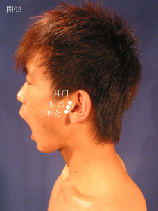 这其中老年性耳聋和突发性耳聋针灸推