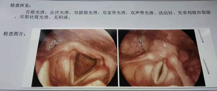 聲帶肉芽腫治驗