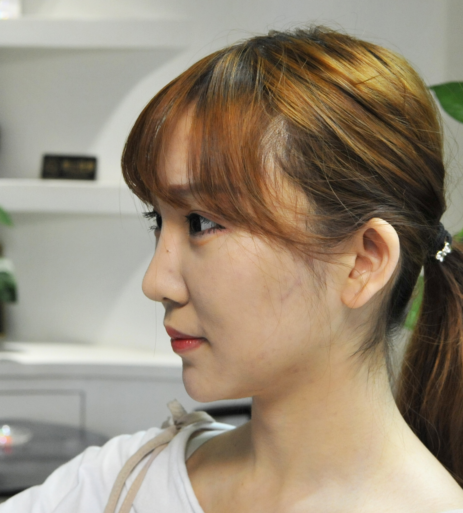 改脸型案例展播