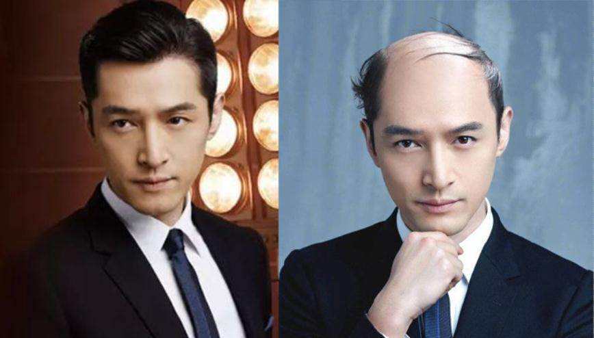 看到这些,植发离你还有多远?