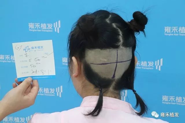 仅500单位雍禾女护士也给自己植发啦13无码图