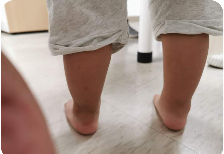 需要找医生看吗?(图片源自网络)小宝宝脚背内侧好像有一块骨