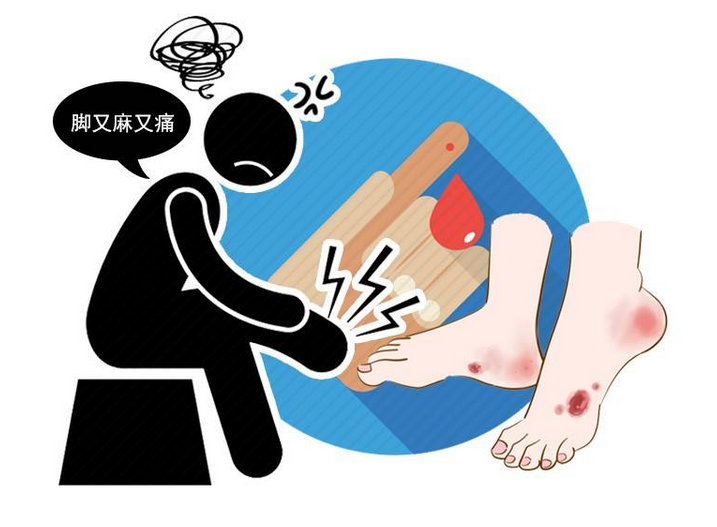 糖尿病足患者术后如何规范护理避免复发