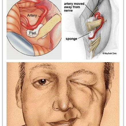 西安交通大学第一附属医院 擅长领域 三叉神经痛,面肌痉挛,舌咽神经痛