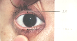 眼睑美容整形外科相关解剖