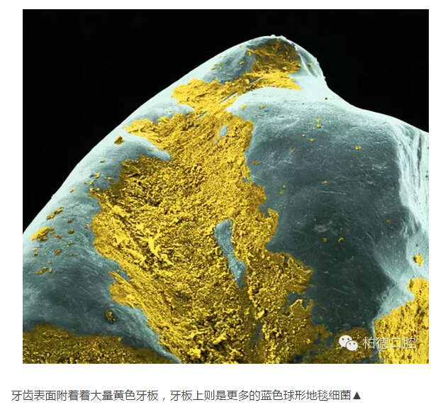 惊呆了看看显微镜下牙齿放大1000倍的样子看你以后还敢不敢不刷牙