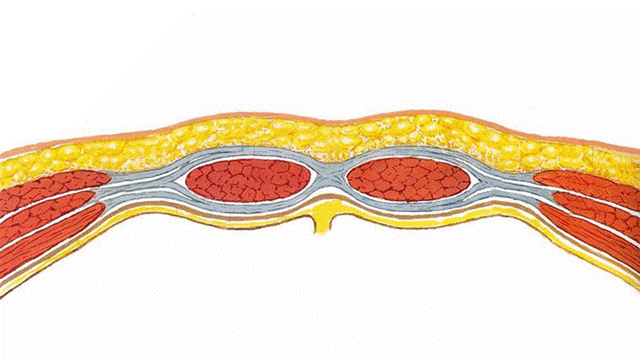 最后一层肌肉,因为是横向走行,所以就叫腹横肌.